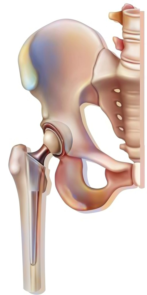 ball joint similar to human hip joint